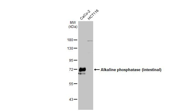 Intestinal Alkaline Phosphatase Antibody in Western Blot (WB)