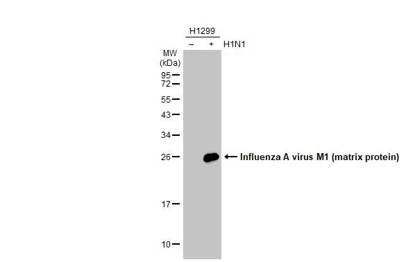 Influenza A M1 (A/Puerto Rico/8/1934) Antibody in Western Blot (WB)