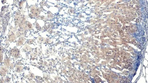 STAR Antibody in Immunohistochemistry (Paraffin) (IHC (P))