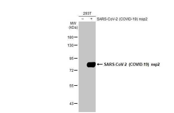 SARS-CoV-2 NSP2 Antibody in Western Blot (WB)