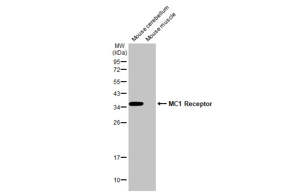 MC1R Antibody in Western Blot (WB)