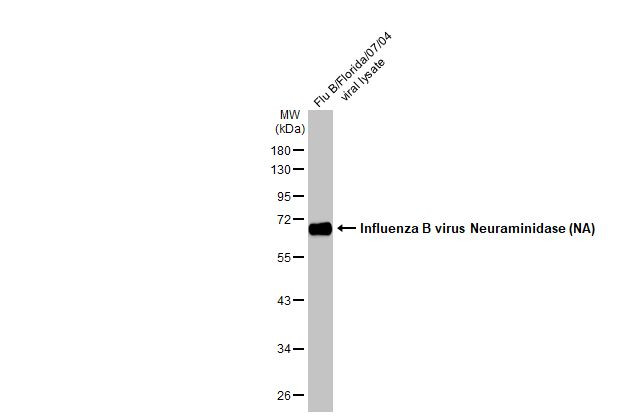 Influenza B NA Antibody in Western Blot (WB)