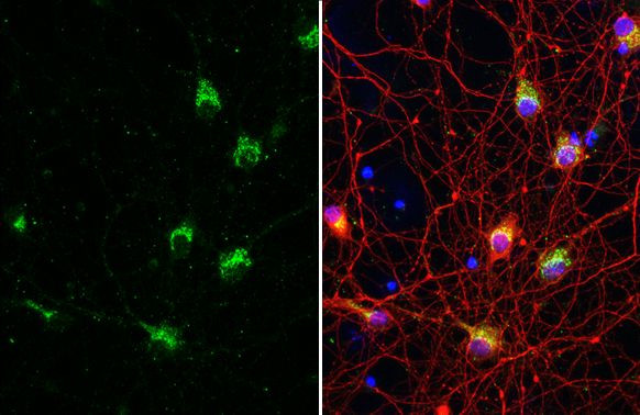 IP3 Receptor 1 Antibody in Immunocytochemistry (ICC/IF)