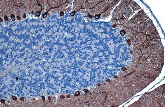 IP3 Receptor 1 Antibody in Immunohistochemistry (Paraffin) (IHC (P))