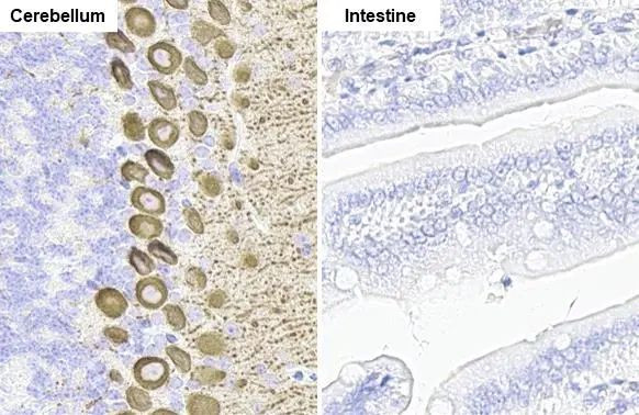 IP3 Receptor 1 Antibody in Immunohistochemistry (Paraffin) (IHC (P))