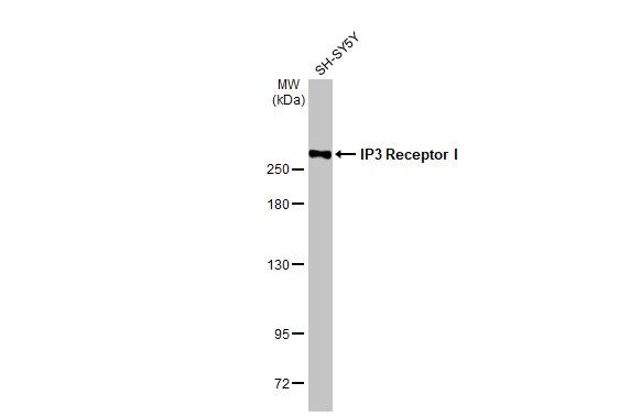 IP3 Receptor 1 Antibody in Western Blot (WB)