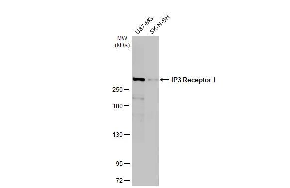 IP3 Receptor 1 Antibody in Western Blot (WB)