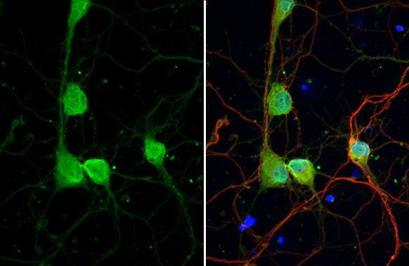 DRD2 Antibody in Immunocytochemistry (ICC/IF)