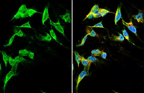 DRD2 Antibody in Immunocytochemistry (ICC/IF)