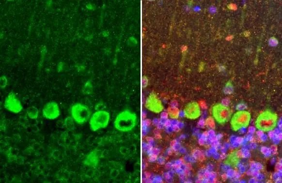 DRD2 Antibody in Immunohistochemistry (Paraffin) (IHC (P))