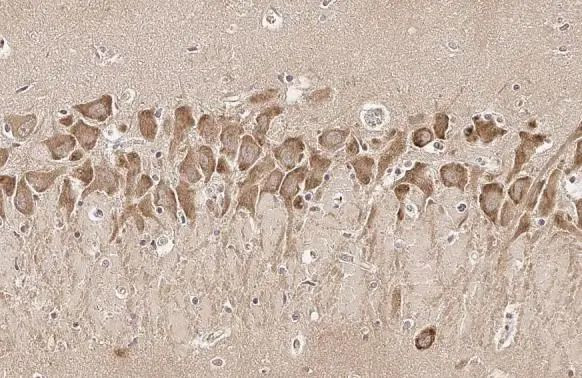 DRD2 Antibody in Immunohistochemistry (Paraffin) (IHC (P))