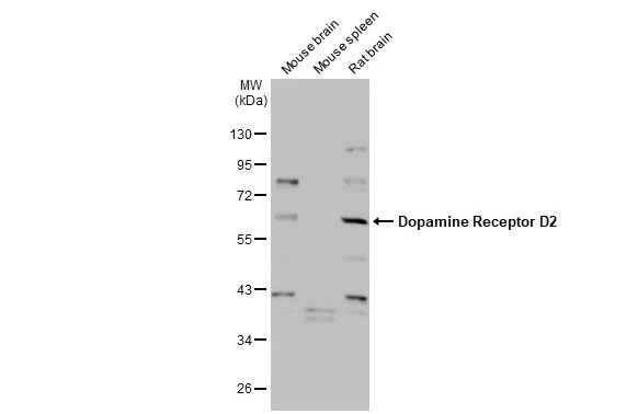 DRD2 Antibody in Western Blot (WB)