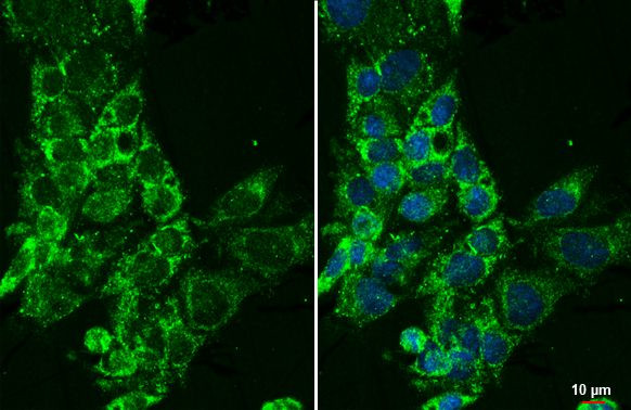 CYP27A1 Antibody in Immunocytochemistry (ICC/IF)