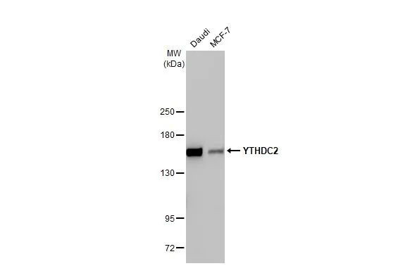 YTHDC2 Antibody in Western Blot (WB)