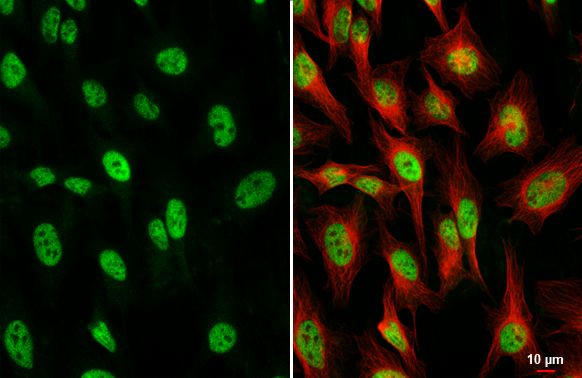 TCF3 Antibody in Immunocytochemistry (ICC/IF)