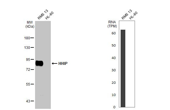 HHIP Antibody in Western Blot (WB)