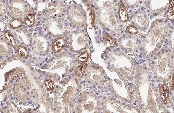 Plasminogen Antibody in Immunohistochemistry (Paraffin) (IHC (P))