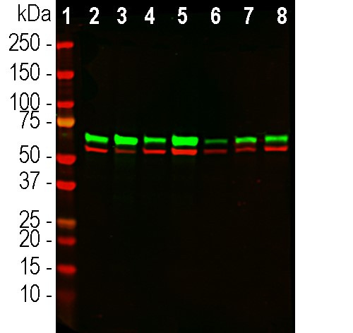 Annexin A6 Antibody in Western Blot (WB)