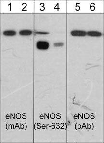 eNOS Antibody in Western Blot (WB)