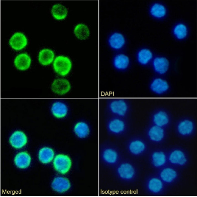 CD25 Chimeric Antibody in Immunocytochemistry (ICC/IF)