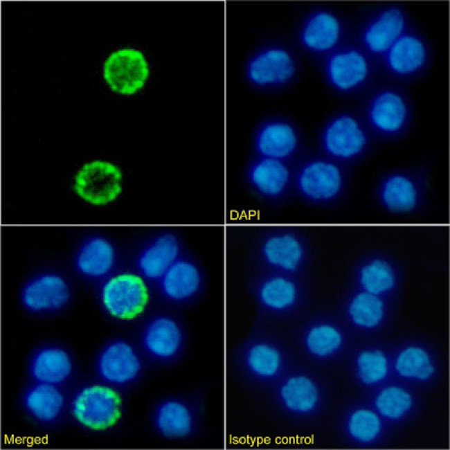 IL2RG Chimeric Antibody in Immunocytochemistry (ICC/IF)