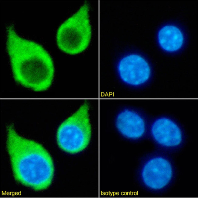 CSF1R Chimeric Antibody in Immunocytochemistry (ICC/IF)