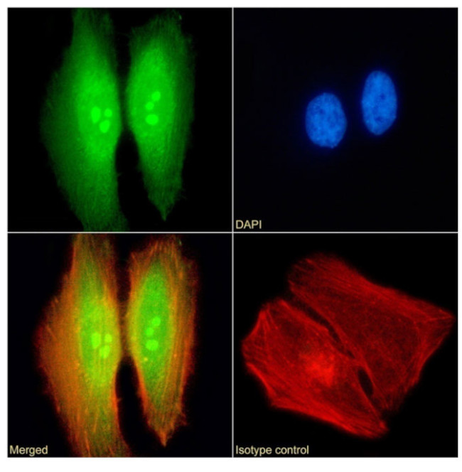 TDRD3 Chimeric Antibody in Immunocytochemistry (ICC/IF)