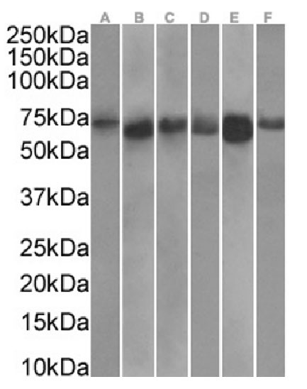 TDRD3 Chimeric Antibody in Western Blot (WB)