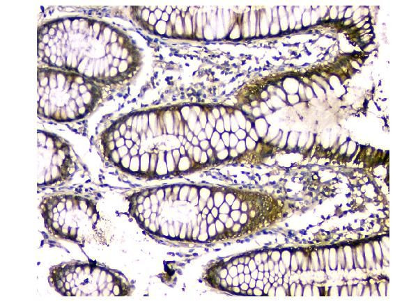 Carbonic Anhydrase II Antibody in Immunohistochemistry (Paraffin) (IHC (P))