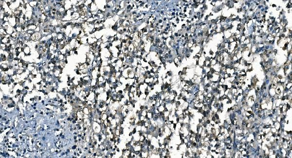 CDC45L Antibody in Immunohistochemistry (Paraffin) (IHC (P))