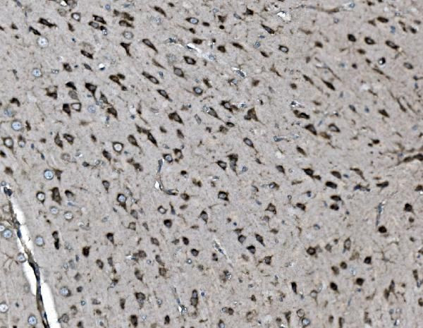 SHIP2 Antibody in Immunohistochemistry (Paraffin) (IHC (P))