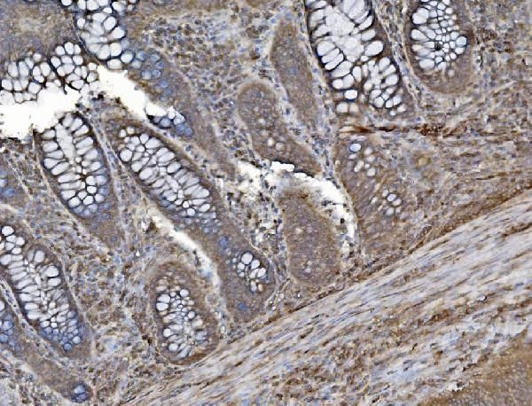 SHIP2 Antibody in Immunohistochemistry (Paraffin) (IHC (P))