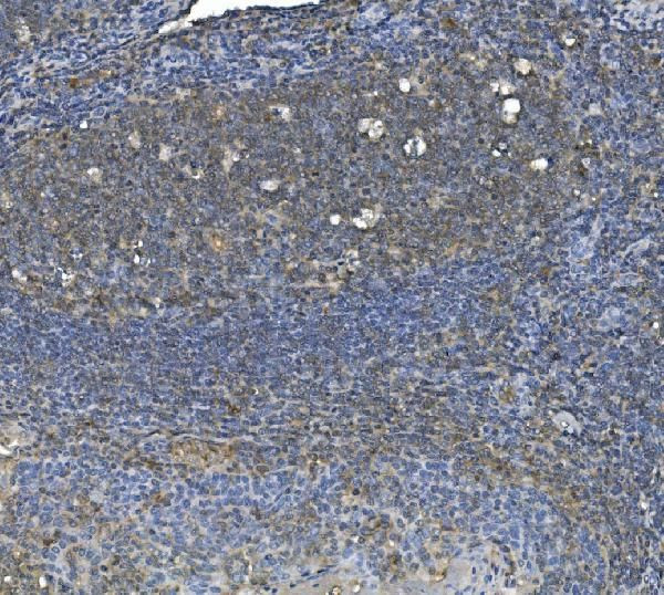 eRF1 Antibody in Immunohistochemistry (Paraffin) (IHC (P))