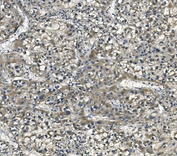 eRF1 Antibody in Immunohistochemistry (Paraffin) (IHC (P))