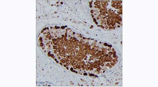 HSP90 alpha Antibody in Immunohistochemistry (Paraffin) (IHC (P))