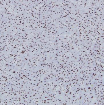 H3K56me3 Antibody in Immunohistochemistry (Paraffin) (IHC (P))