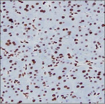 H3K9ac Antibody in Immunohistochemistry (Paraffin) (IHC (P))