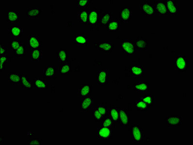 H4K16me1 Antibody in Immunocytochemistry (ICC/IF)