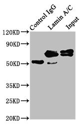 Lamin A Antibody in Immunoprecipitation (IP)