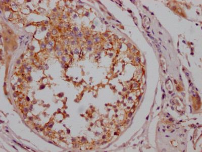 B-Raf Antibody in Immunohistochemistry (Paraffin) (IHC (P))