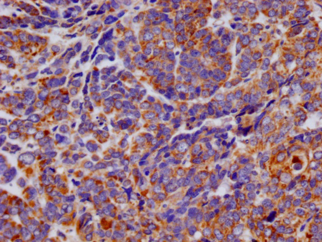 FIS1 Antibody in Immunohistochemistry (Paraffin) (IHC (P))