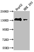 MYLK Antibody in Western Blot (WB)