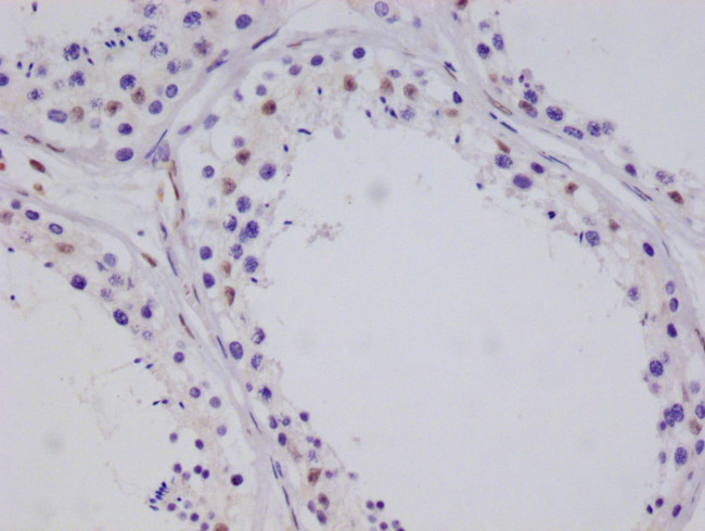 CRTC3 Antibody in Immunohistochemistry (Paraffin) (IHC (P))