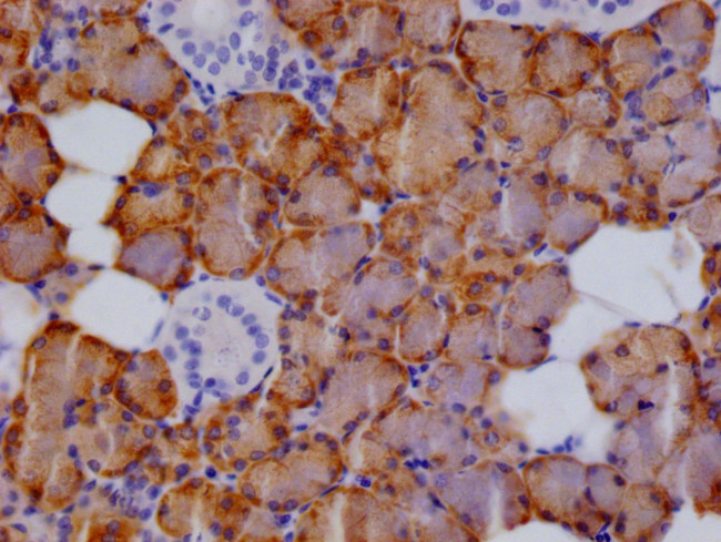 CTPS Antibody in Immunohistochemistry (Paraffin) (IHC (P))