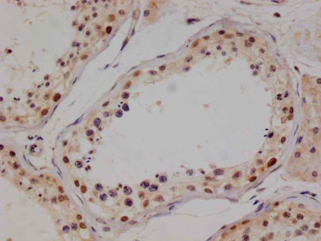 PIN4 Antibody in Immunohistochemistry (Paraffin) (IHC (P))