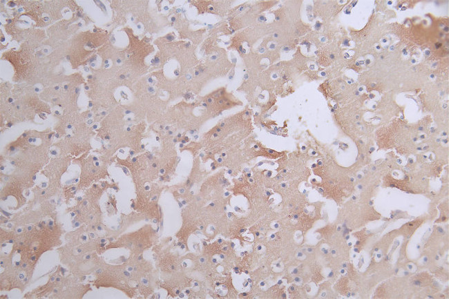 Phospho-Tau (Ser404) Antibody in Immunohistochemistry (Paraffin) (IHC (P))