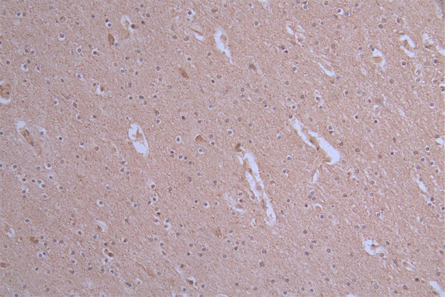 ATP7B Antibody in Immunohistochemistry (Paraffin) (IHC (P))