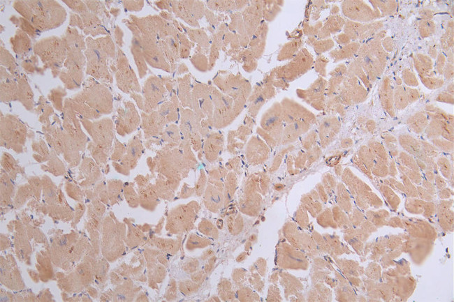 SERCA2 ATPase Antibody in Immunohistochemistry (Paraffin) (IHC (P))