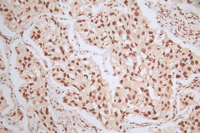 Phospho-MDM2 (Ser166) Antibody in Immunohistochemistry (Paraffin) (IHC (P))