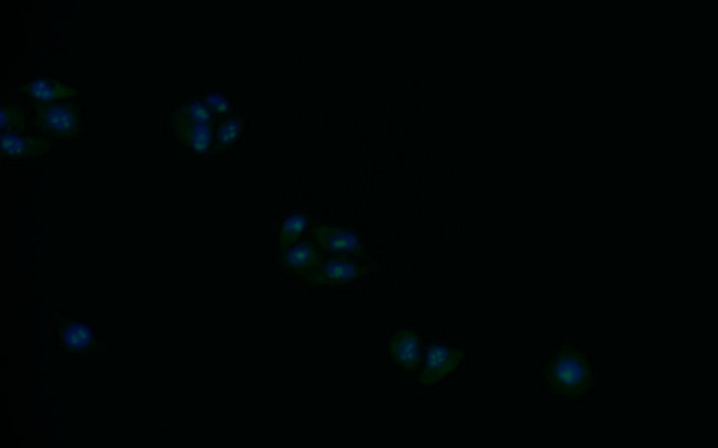 Syntenin 1 Antibody in Immunocytochemistry (ICC/IF)